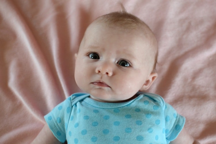 Image of a baby girl suffers from Torticollis.