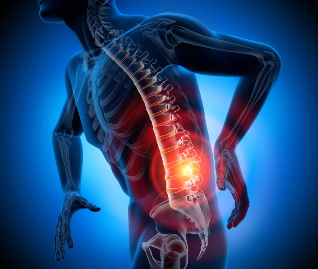 bulging-disc-diamond-chiropractic
